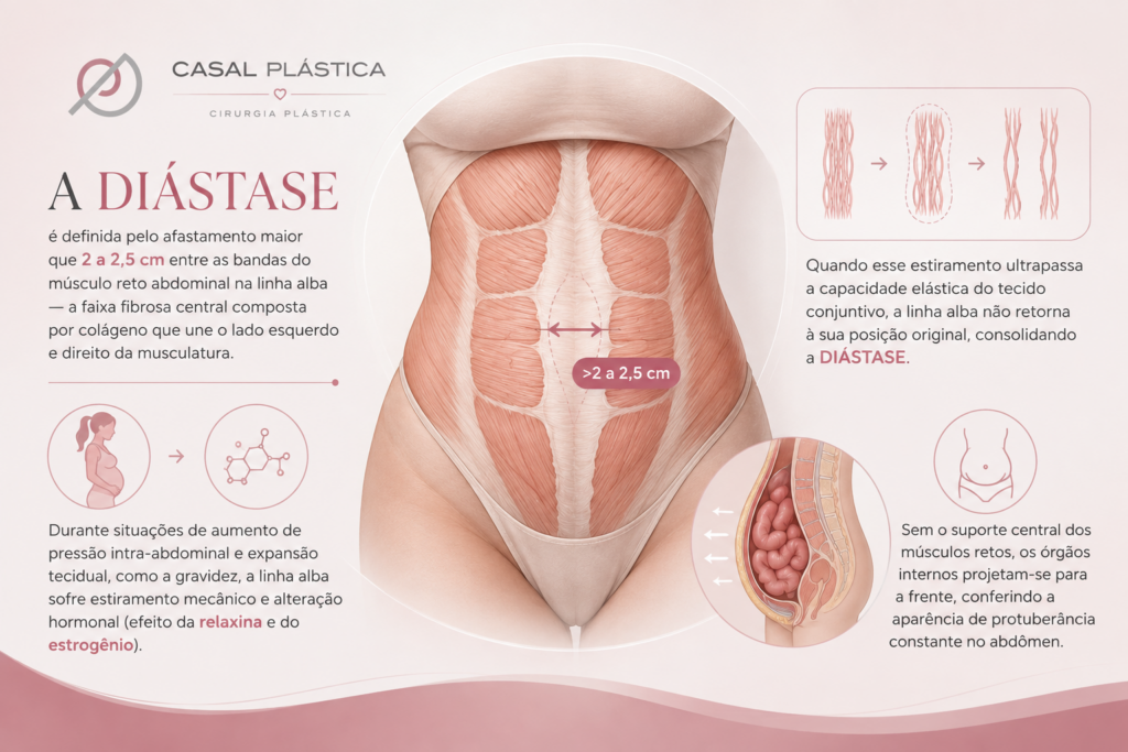 diástase abdominal